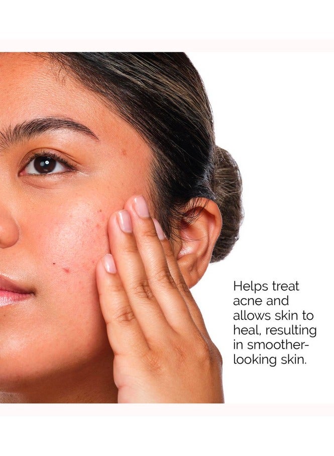 ذا اورديناري مجموعة علاج حب الشباب العادية - Image 5